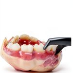 Periodontics 8th Edition Kindle eBook by Jones & Bartlett Learning-0