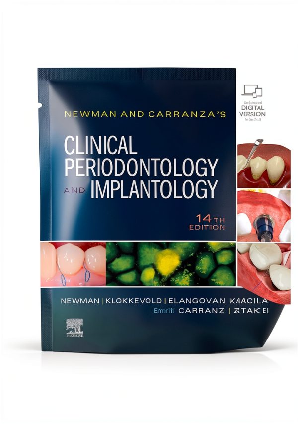 Periodontics 14th Edition by Saunders Comprehensive Kindle eBook-0