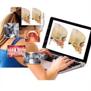 Periodontics Essentials by Elsevier Kindle eBook 1st Edition 339 Pages-0