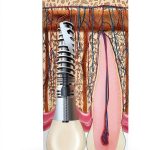 Periodontics Kindle eBook by Quintessence Publishing First Edition-0