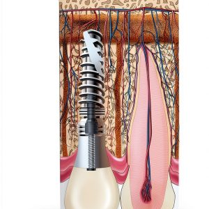 Periodontics Kindle eBook by Quintessence Publishing First Edition-0