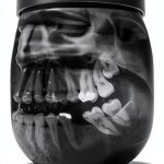 Periodontics Guide by David Vine D.D.S. Kindle eBook 176 Pages-0